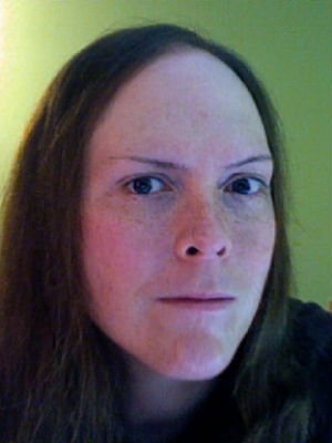 Carissa Hannigan Electrolysis